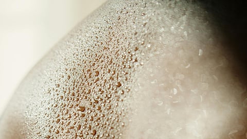 Heat rashes: Five ways to bid them goodbye this summer