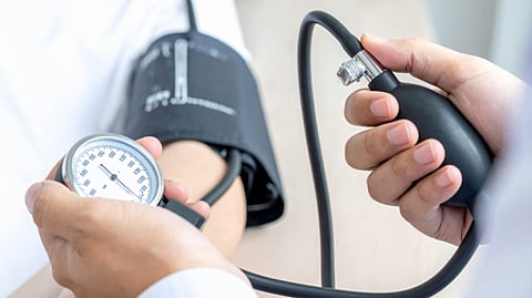 For representation purposes only