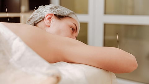 Can Acupuncture be the answer to back pain?