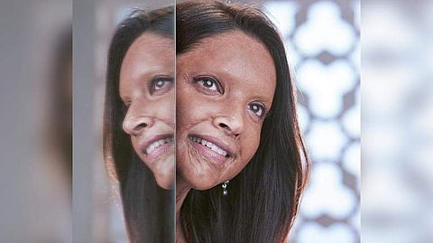 Deepika Padukone in Chhapaak. Source: Internet