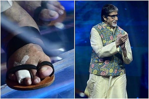 Amitabh Bachchan had fractured his toes on the sets of Kaun Banega Crorepati 13