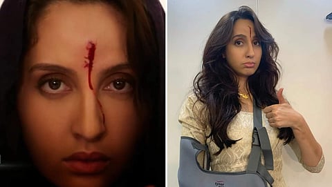 Nora Fatehi received a real injury and shed blood on the sets of Bhuj: The Pride of India