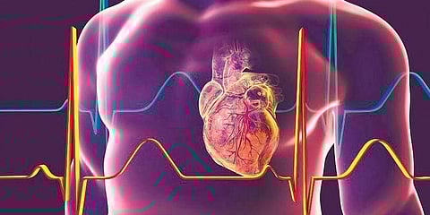 HIV patients are prone to heart attack