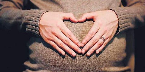 Representational image