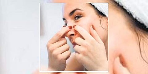 Representational image