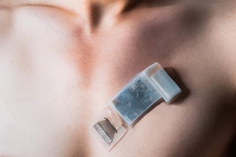 New wearable ultrasound system can monitor BP, heart function on the go