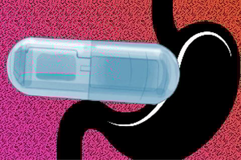 Indian-origin MIT engineer develops vibrating pill to help treat obesity
