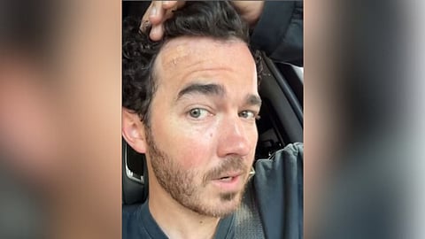 Kevin Jonas after undergoing the surgery 