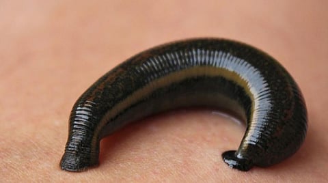 Leech survival hacks: How to survive these pests during the Indian monsoon 