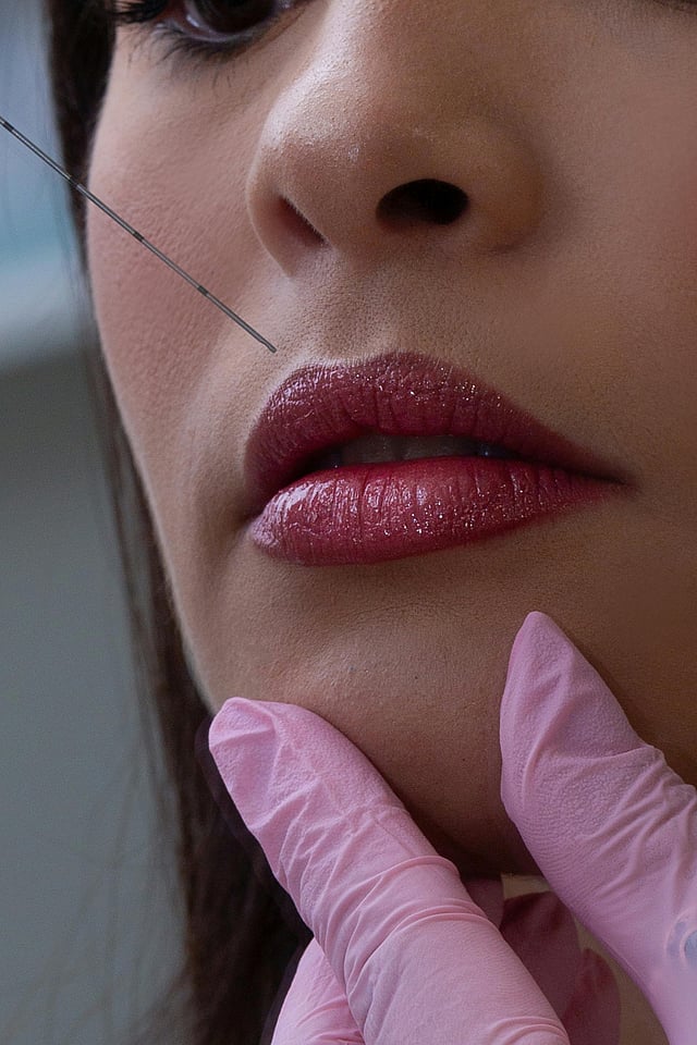 Thinking of lip fillers? Don’t miss this kissing guide