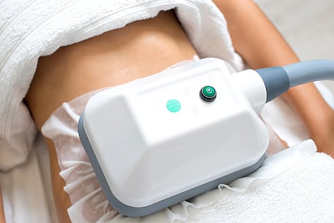Freeze the fat, feel the glow: Why CoolSculpting is winter’s hottest wellness trend?