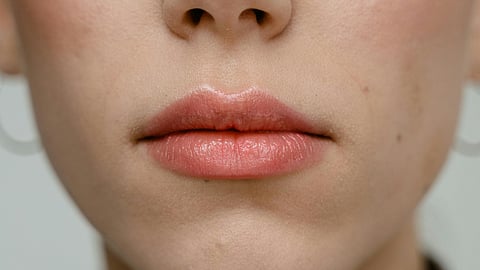 How to erase pigmentation around the lips?