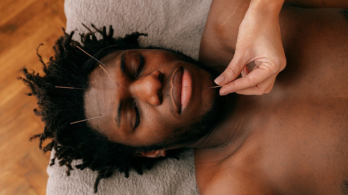 Facial acupuncture: What to know about this celeb-approved treatment