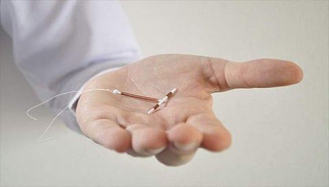 IUDs may prevent cervical cancer risk