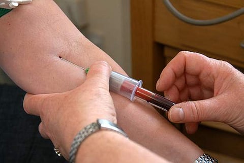 High blood platelet levels 'strong predictor' of cancer