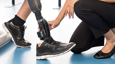 amputation-prosthetic-leg