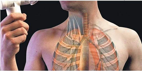 For representational purposes