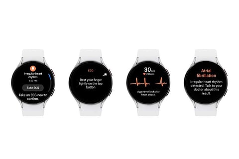 Samsung_Galaxy_Watchs_Irregular_Heart_Rhythm_Notification_feature_cleared_by_FDA